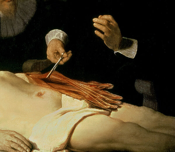 A lição de anatomia do Dr. Nicolaes Tulp, 1632 (detalhe de 7543) de Rembrandt van Rijn Rembrandt van Rijn Artemis Reproduction